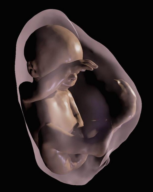 3D virtual model MRI view of fetus